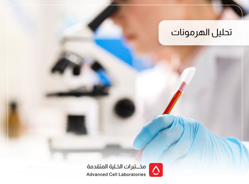 تحليل الهرمونات: دليلك الشامل لفحوصات الهرمونات في السعودية